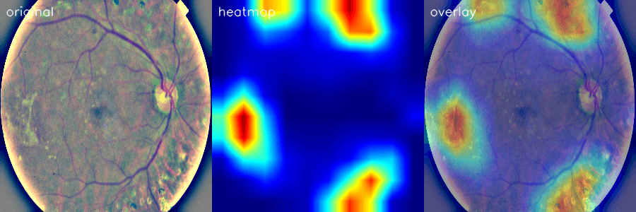 Example Retra heatmap output